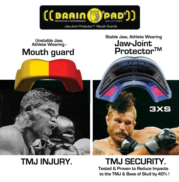 Morgan Brain Pad 3XS Mouth Guard
